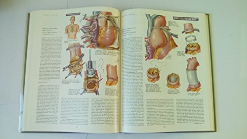 Heart (CIBA Collection of Medical Illustrations, Volume 5)